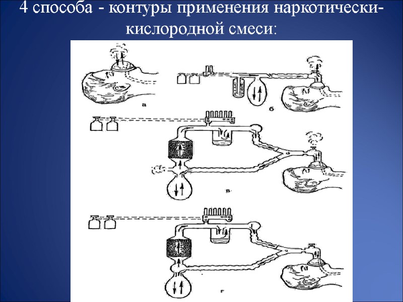 4 способа - контуры применения наркотически-кислородной смеси:
